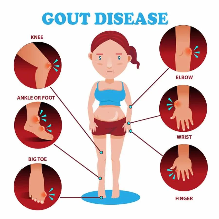 What is Gout?